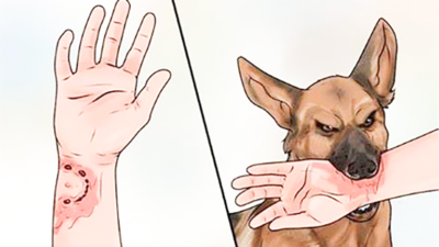 Tiêm ngừa dại cần đúng lịch, đúng mũi để bảo vệ an toàn tuyệt đối.